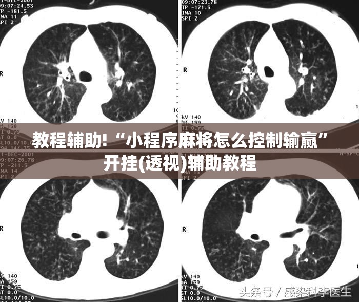 教程辅助!“小程序麻将怎么控制输赢”开挂(透视)辅助教程