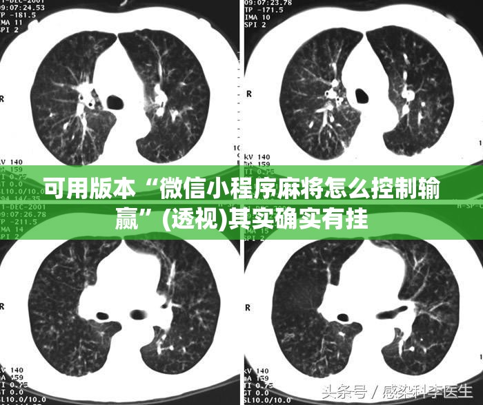 可用版本“微信小程序麻将怎么控制输赢”(透视)其实确实有挂